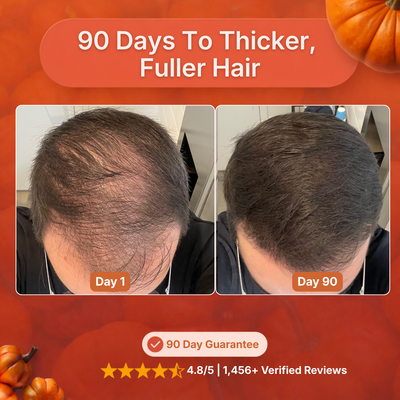 Nuven Pumpkin Seed Oil + Saw Palmetto