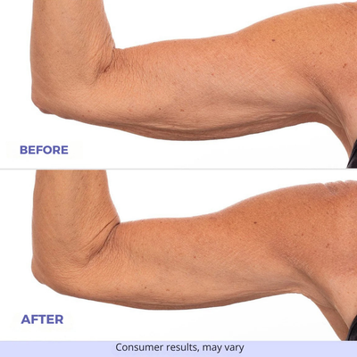 Relifted - Sculpt & Tone Arm Cream