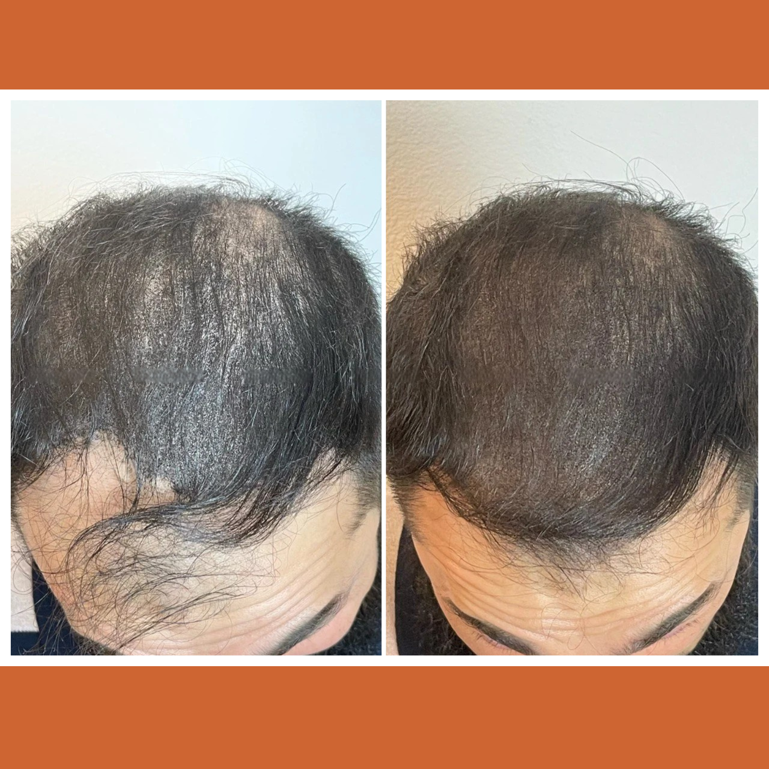 Feature product image